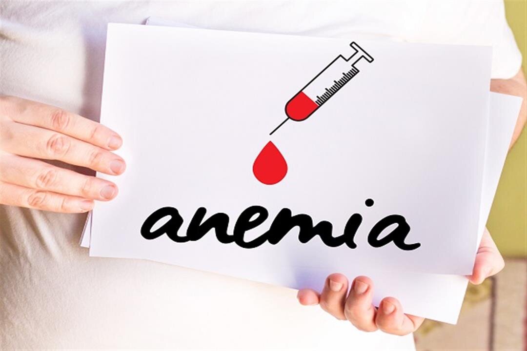 Anemia